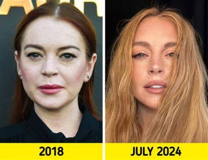 Why Lindsay Lohan's Appearance Has Changed